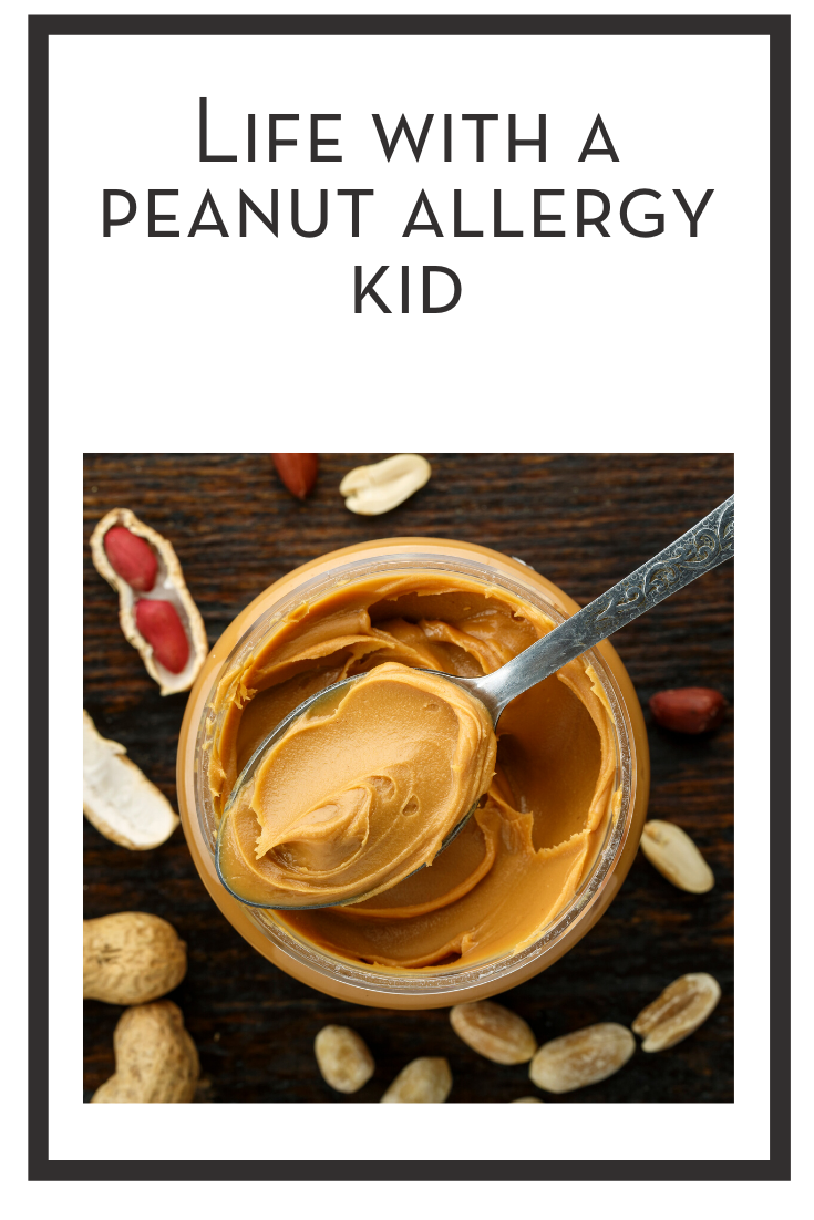life with a peanut allergy kid