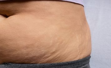 The Things I Wish I Had Known About Postpartum Recovery